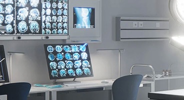 Bildschirme mit MRT Aufnahmen in einem Röntgenzentrum